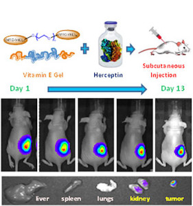 penelitian tumor payudara